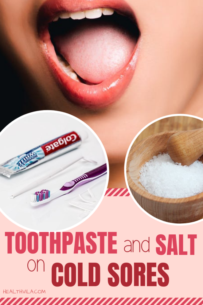 toothpaste-salt-cold-sores-overnight-health-vila